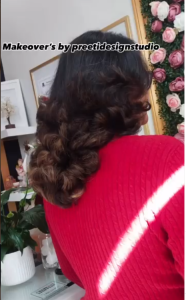 pigmentation treatment Brampton