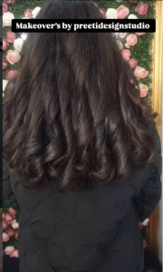 laser hair removal Brampton